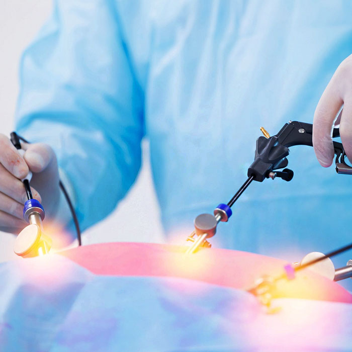 Laparoscopic Surgery
